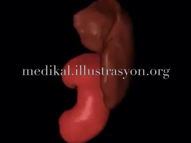 Creating computer aided 3D model of spleen and kidney based on Visible Human Project